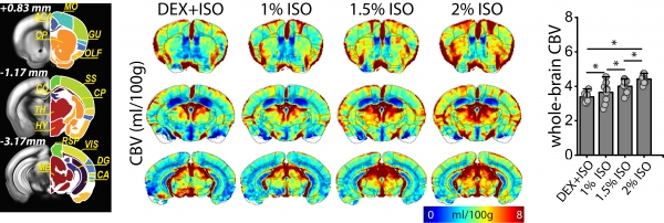 덱스메데토미딘+아이소플루레인(0.3%), 아이소플루레인(1%·1.5%·2%) 등 4가지 마취 조건에서 뇌 혈류지표를 측정·계산해 쥐 MRI 뇌 영상에 맵핑한 영상과 수치 결과 / IBS